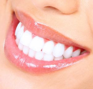 Teeth Whitening Specialist Houston | Teeth whitening near me - Arc dental