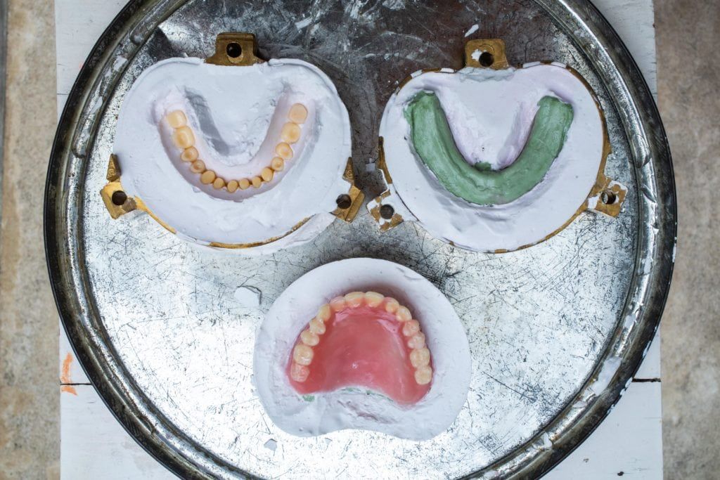 What Is The Process For Getting Dentures? Arc Dental