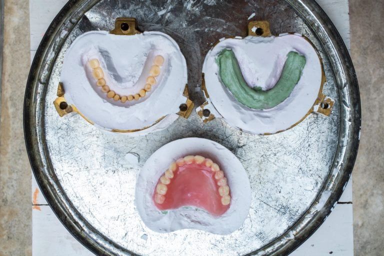 Denture process